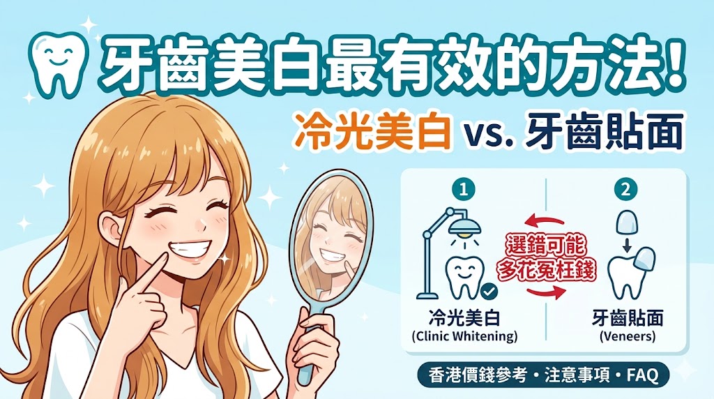 《牙齒美白最有效的方法：冷光美白 vs 牙齒貼面，選錯可能多花冤枉錢》